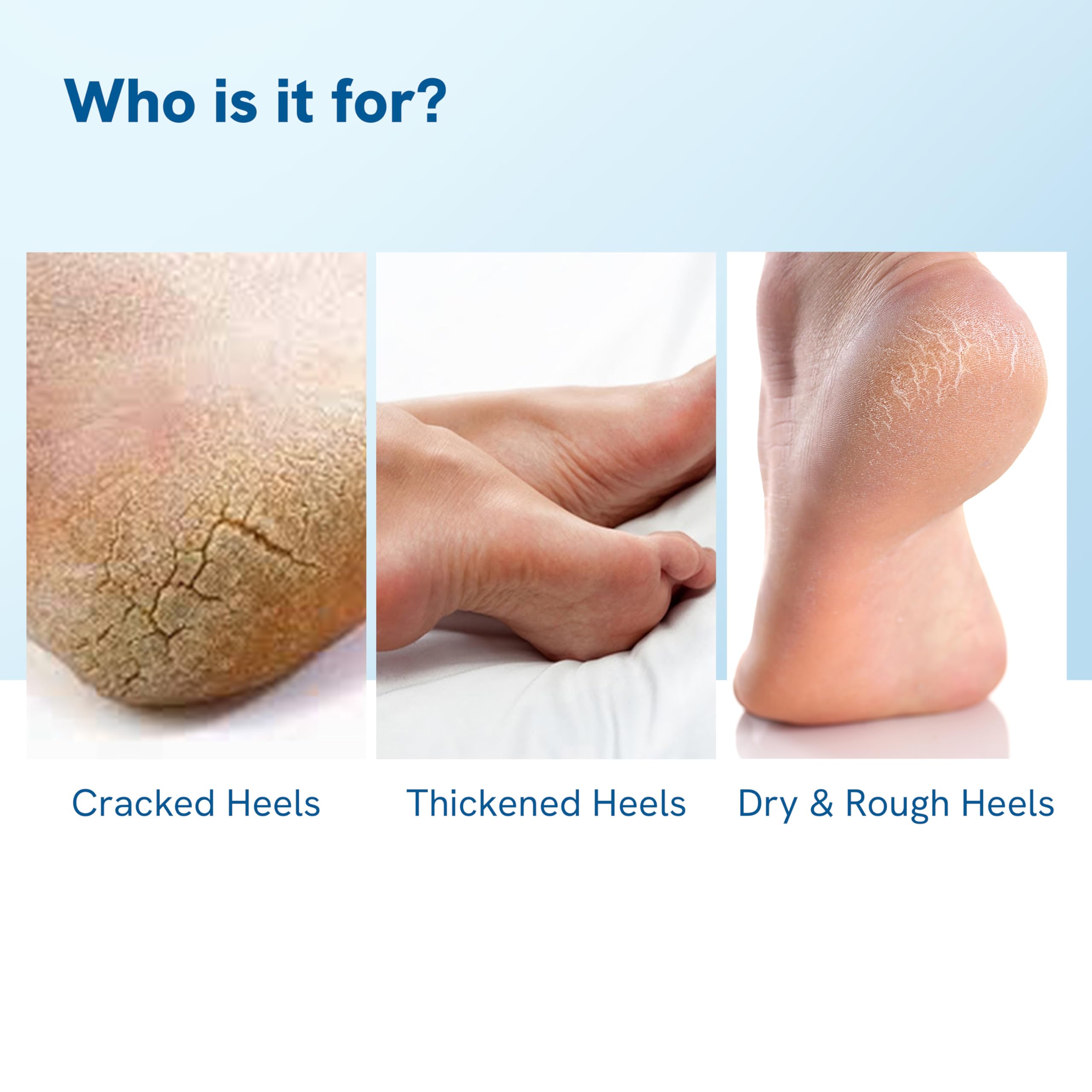 20% Urea Foot Cream Roll On