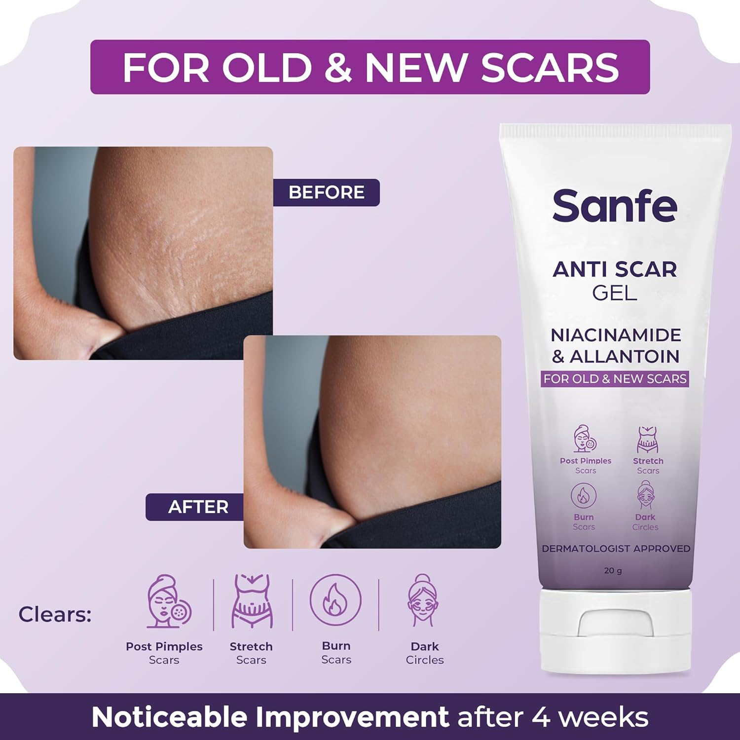 Anti Scar Gel