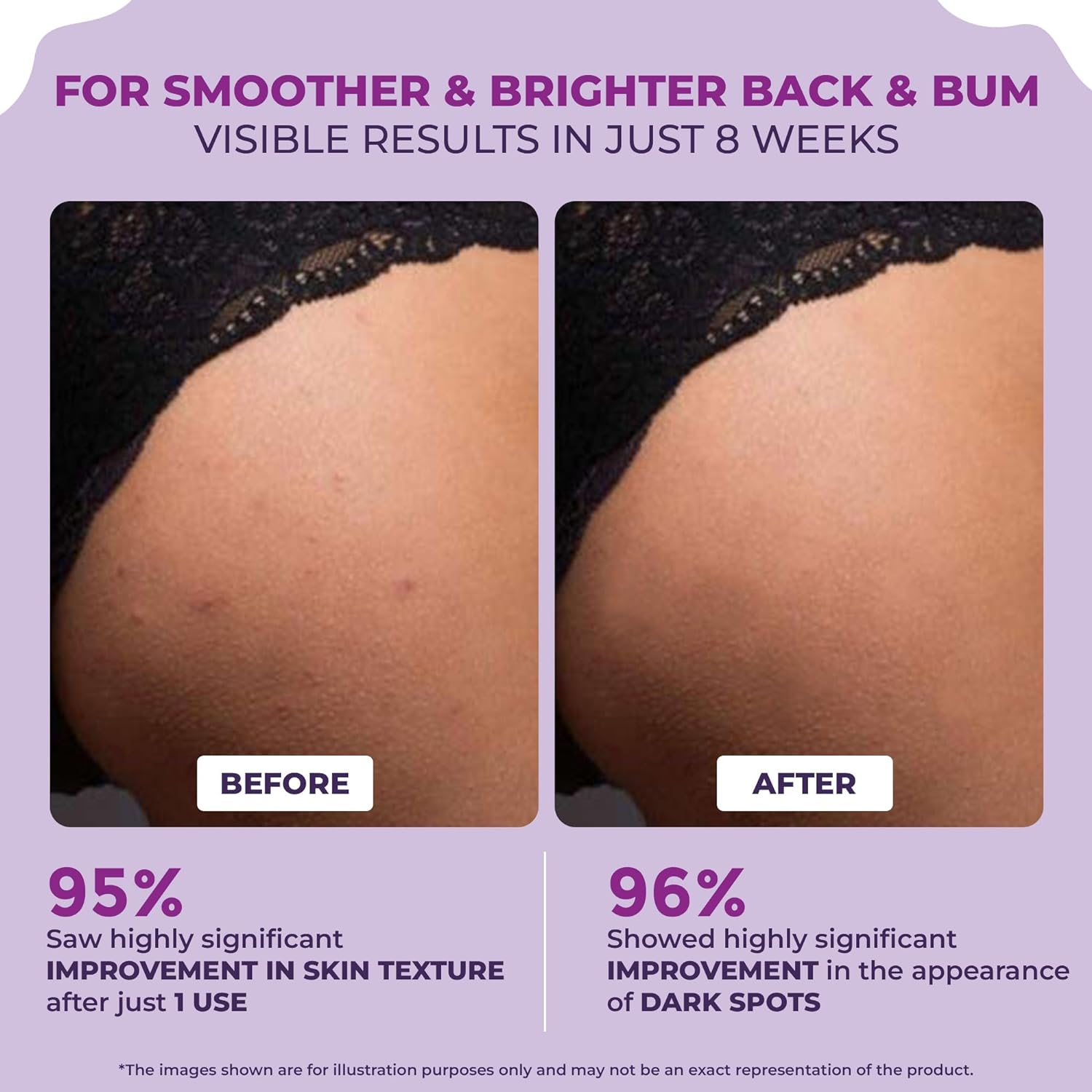 Back & Bum Lightening Cream