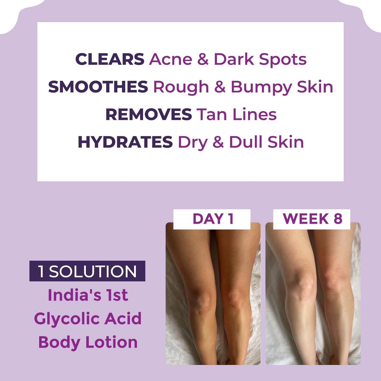 Glycolic Acid Body Lotion