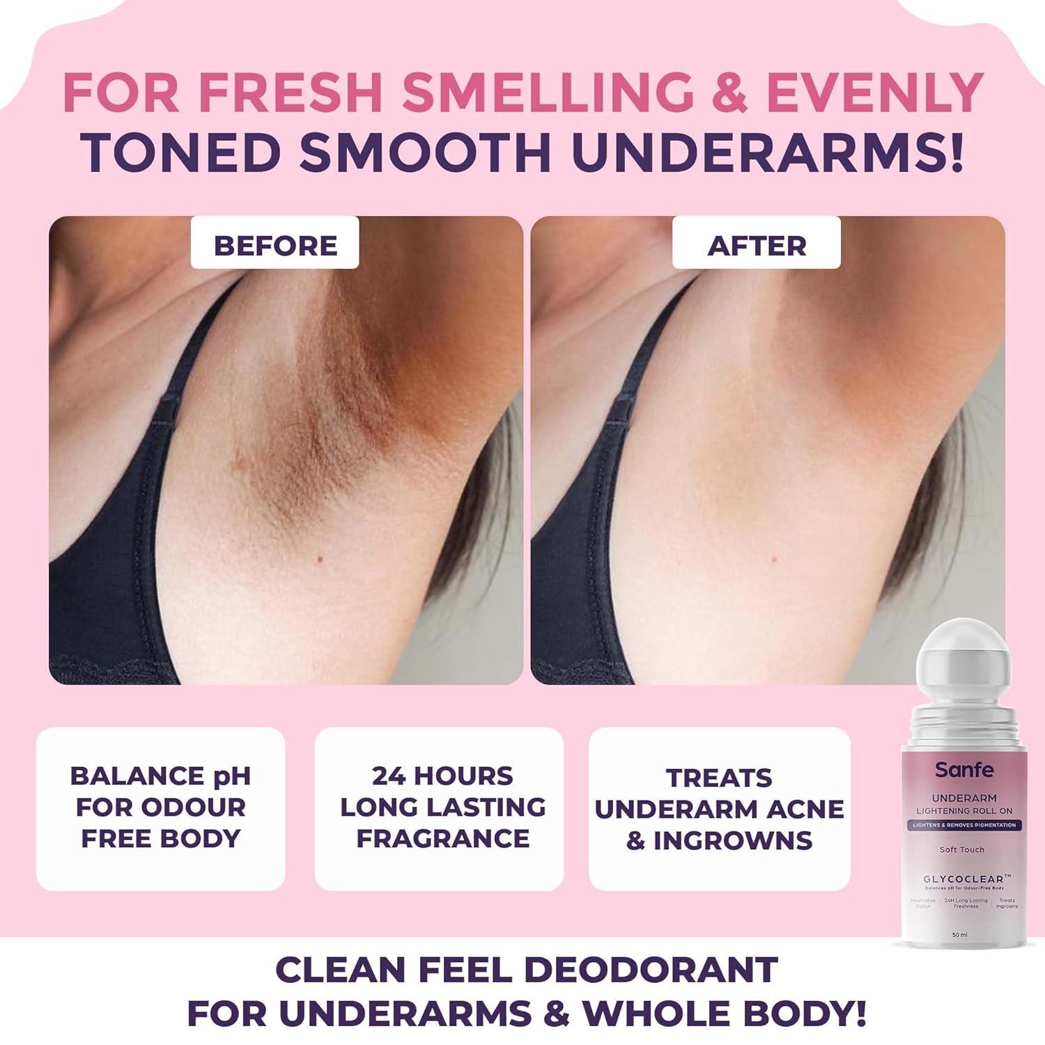 Underarm Lightening Roll On (Soft Touch)