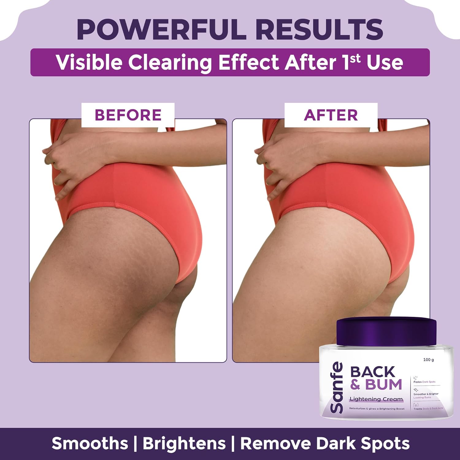 Back & Bum Lightening Cream