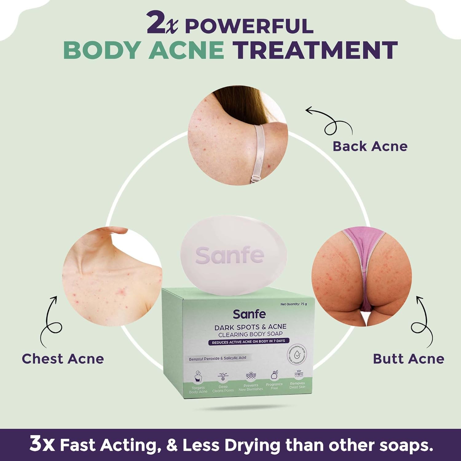 Dark Spots & Acne Clearing Body Soap