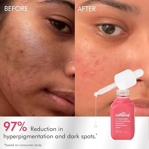 Advanced Pigmentation Serum